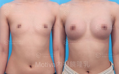 MOTIVA魔滴-1