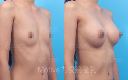 MOTIVA魔滴-11
