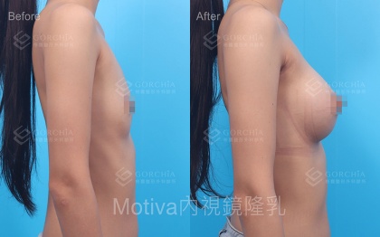 MOTIVA魔滴-12