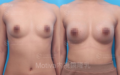 MOTIVA魔滴-13
