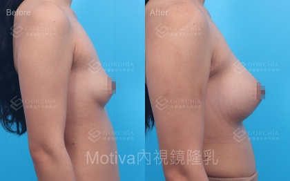 MOTIVA魔滴-15
