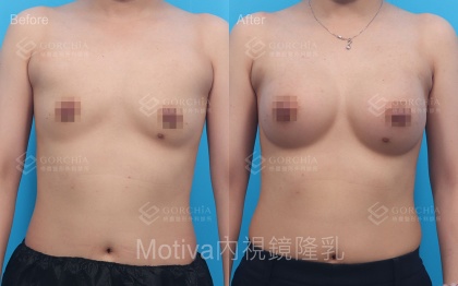 MOTIVA魔滴-16