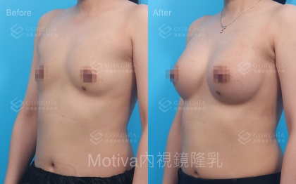 MOTIVA魔滴-17