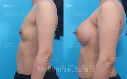 MOTIVA魔滴-18
