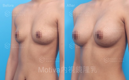MOTIVA魔滴-20