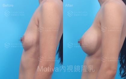 MOTIVA魔滴-24