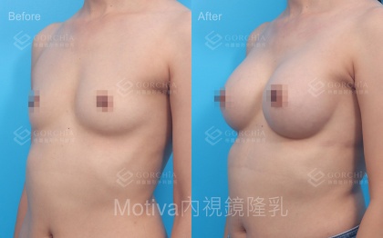 MOTIVA魔滴-26