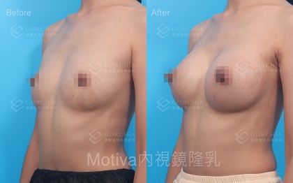 MOTIVA魔滴-29