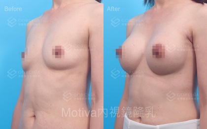 MOTIVA魔滴-32