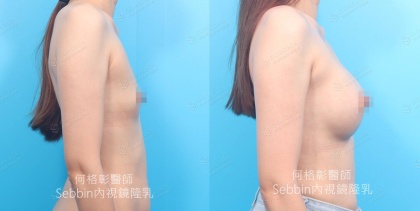 SEBBIN柔滴-5