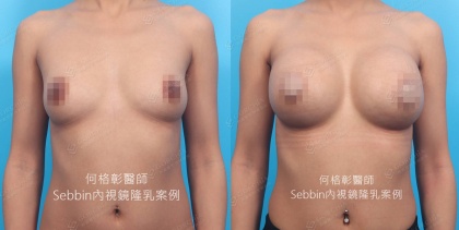 SEBBIN柔滴-6
