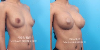 SEBBIN柔滴-8