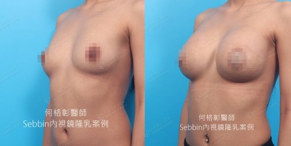 SEBBIN柔滴-10