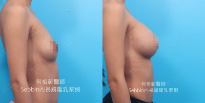 SEBBIN柔滴-11