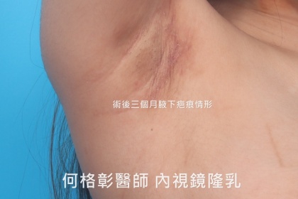 SEBBIN柔滴-12
