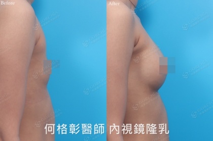 SEBBIN柔滴-13