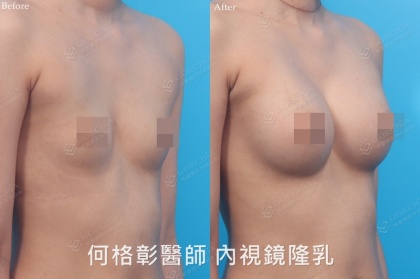 SEBBIN柔滴-15