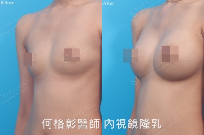 SEBBIN柔滴-17