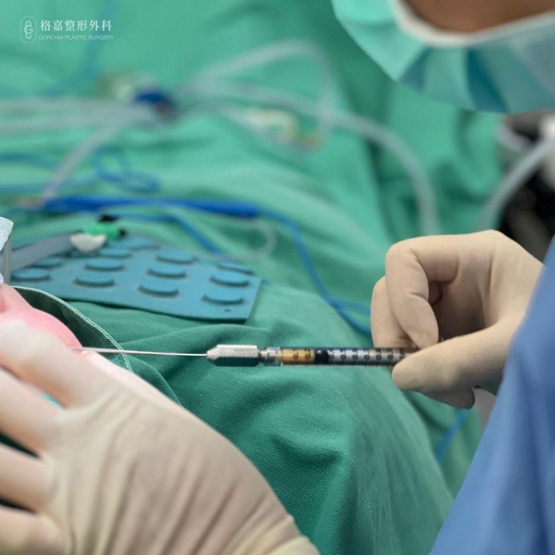 提眼肌調整高度與功能平衡示意(版型測試圖)