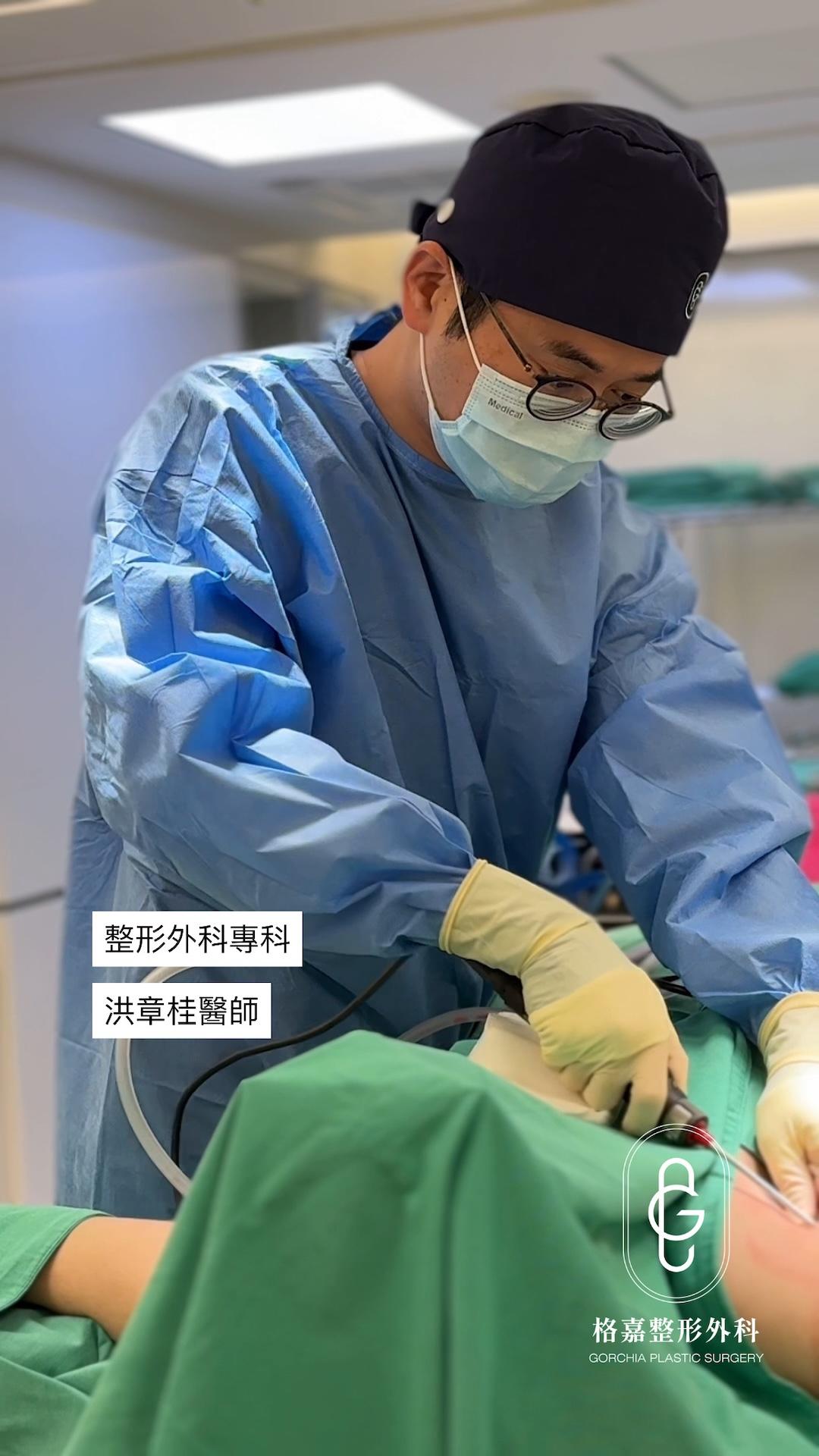 格嘉整形外科狐臭微創旋轉刀 Shaver 手術與組織膠