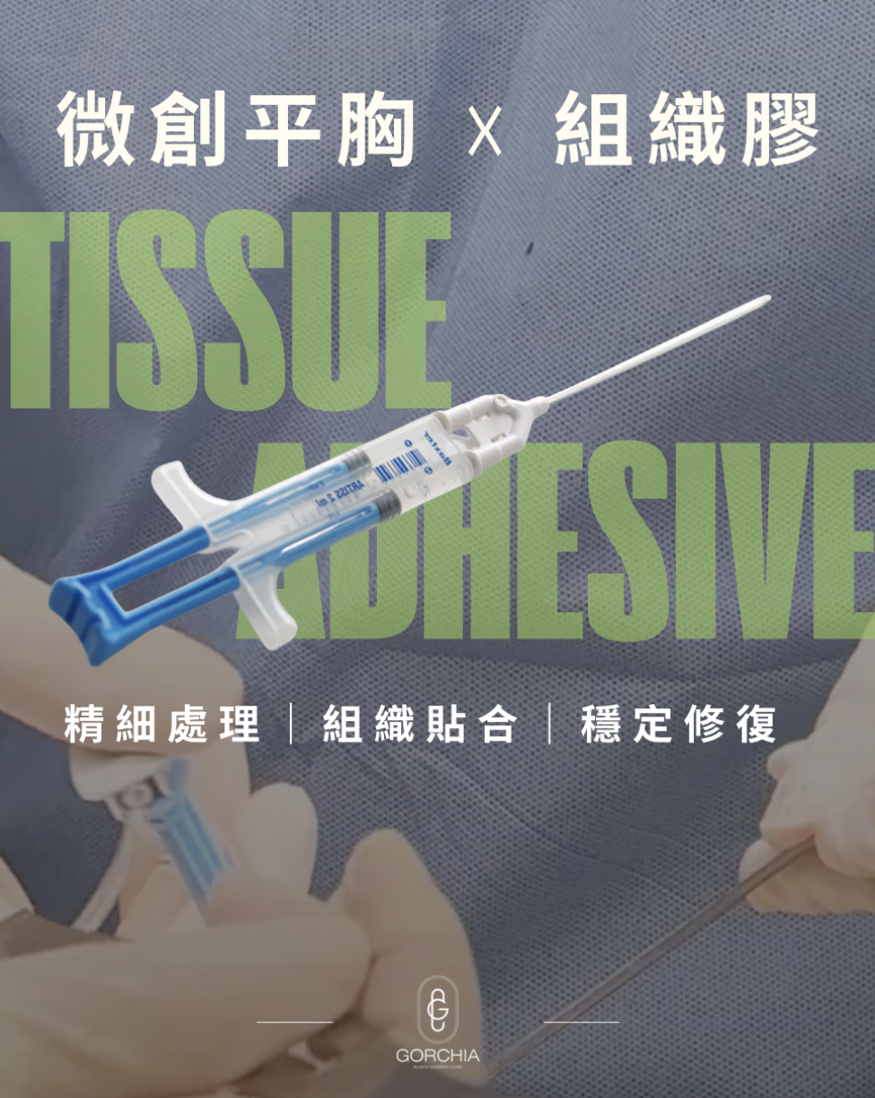 組織膠協助微創平胸術後皮瓣與胸壁貼合