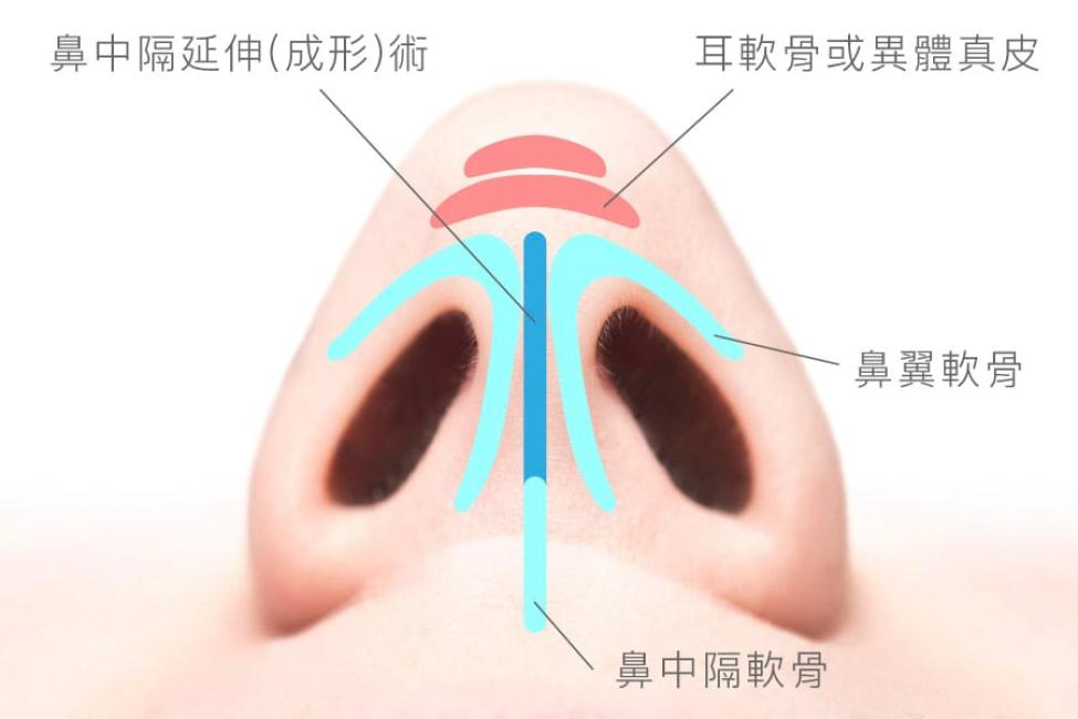 鼻頭凸度鼻長與鼻尖旋轉角度三度空間示意
