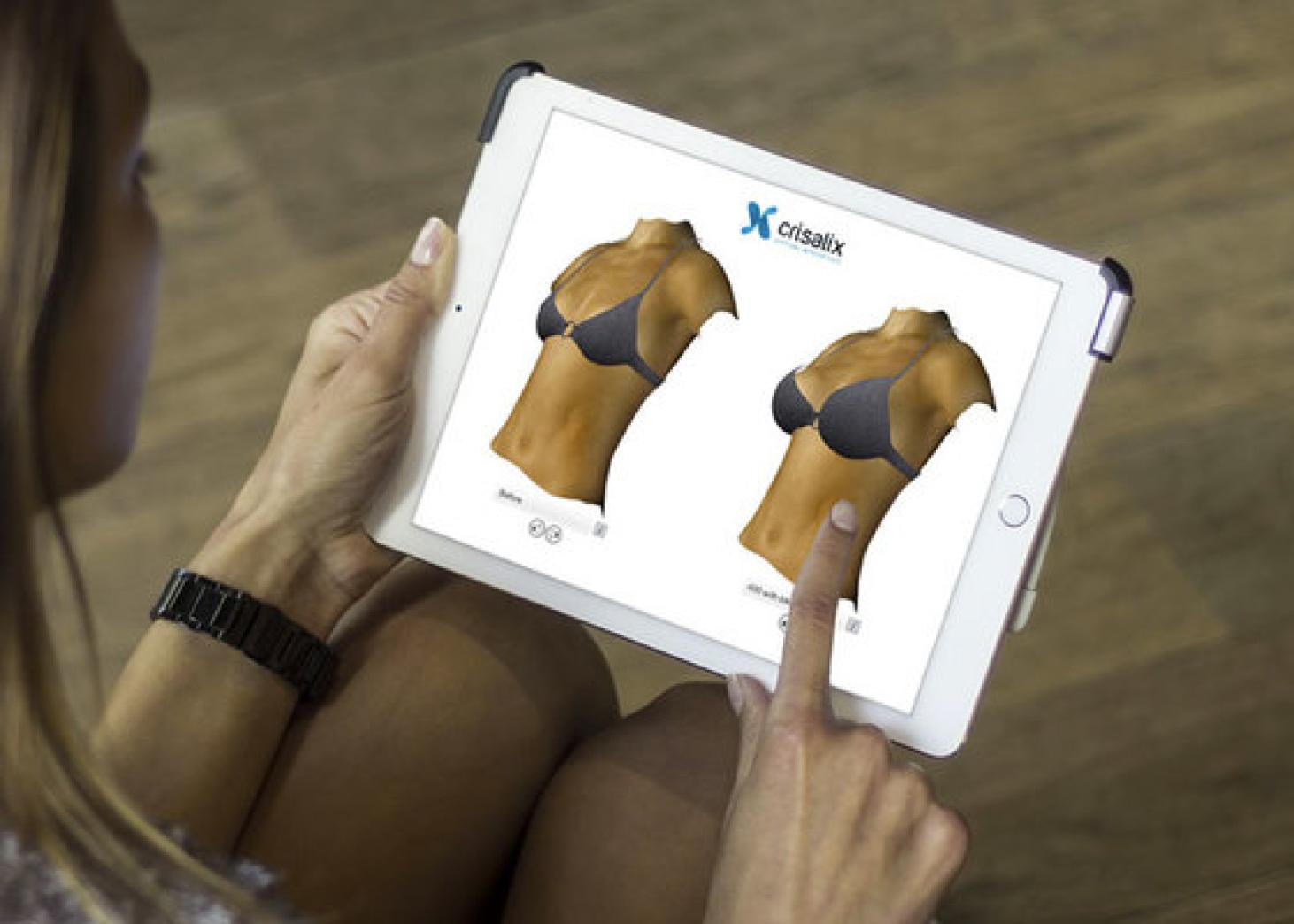 Crisalix 3D 隆乳術前模擬