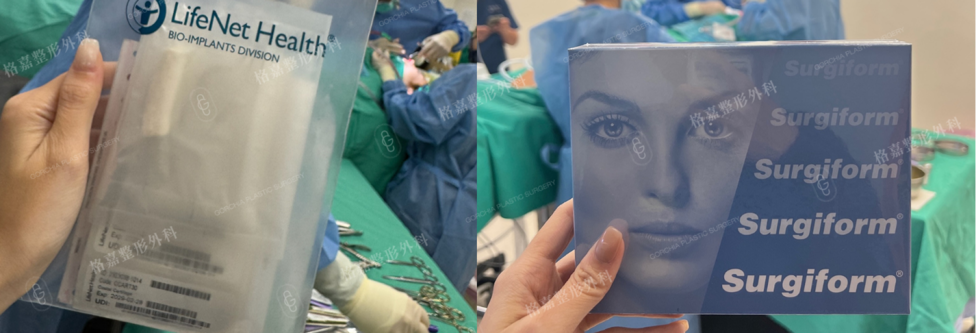 結構式隆鼻自體肋軟骨異體肋軟骨耳軟骨與鼻背材料使用示意