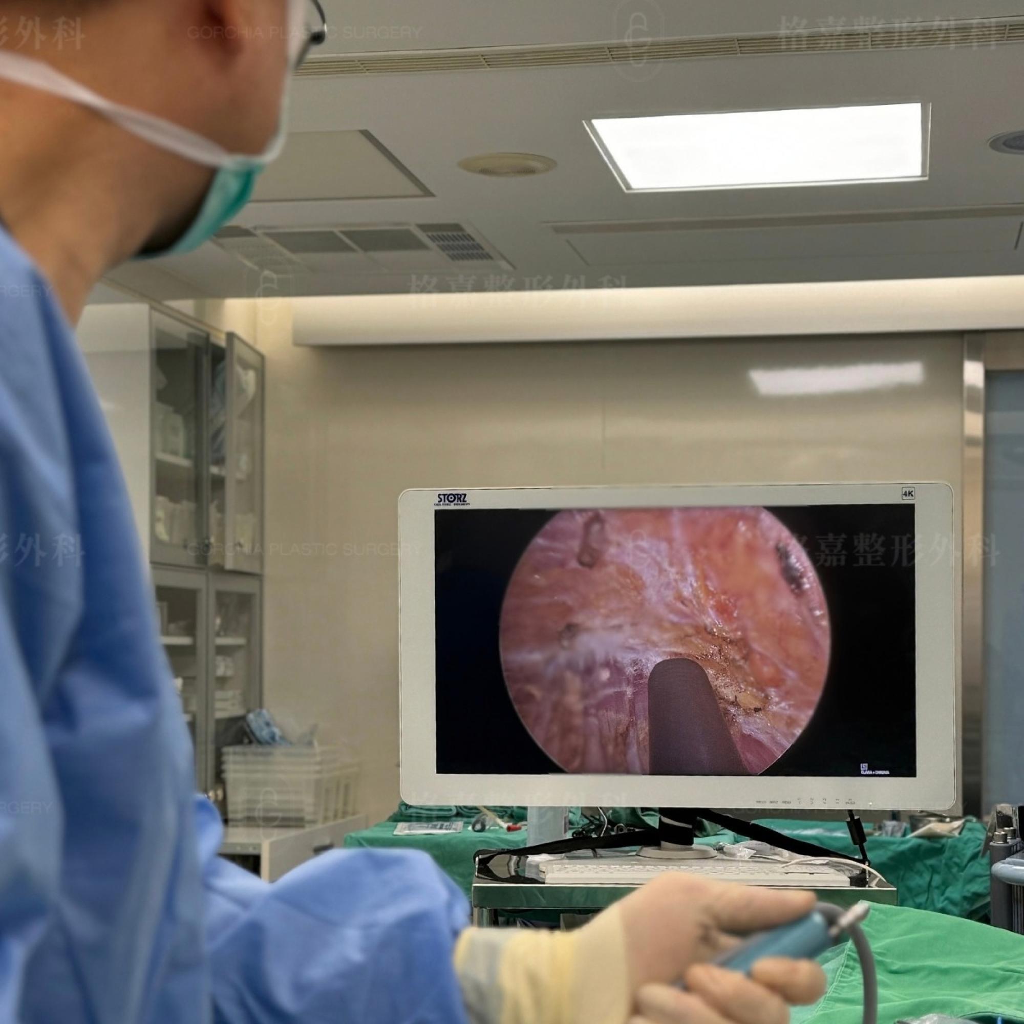 內視鏡隆乳手術視野