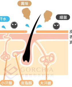 旋轉刀狐臭手術