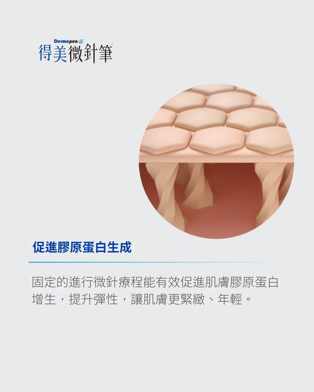 膠原蛋白增生