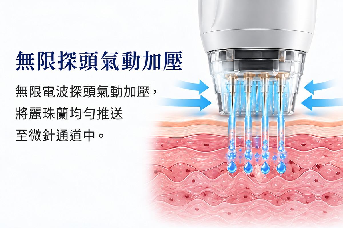 POTENZA Fusion Tip 微針通道與外用配方導入示意