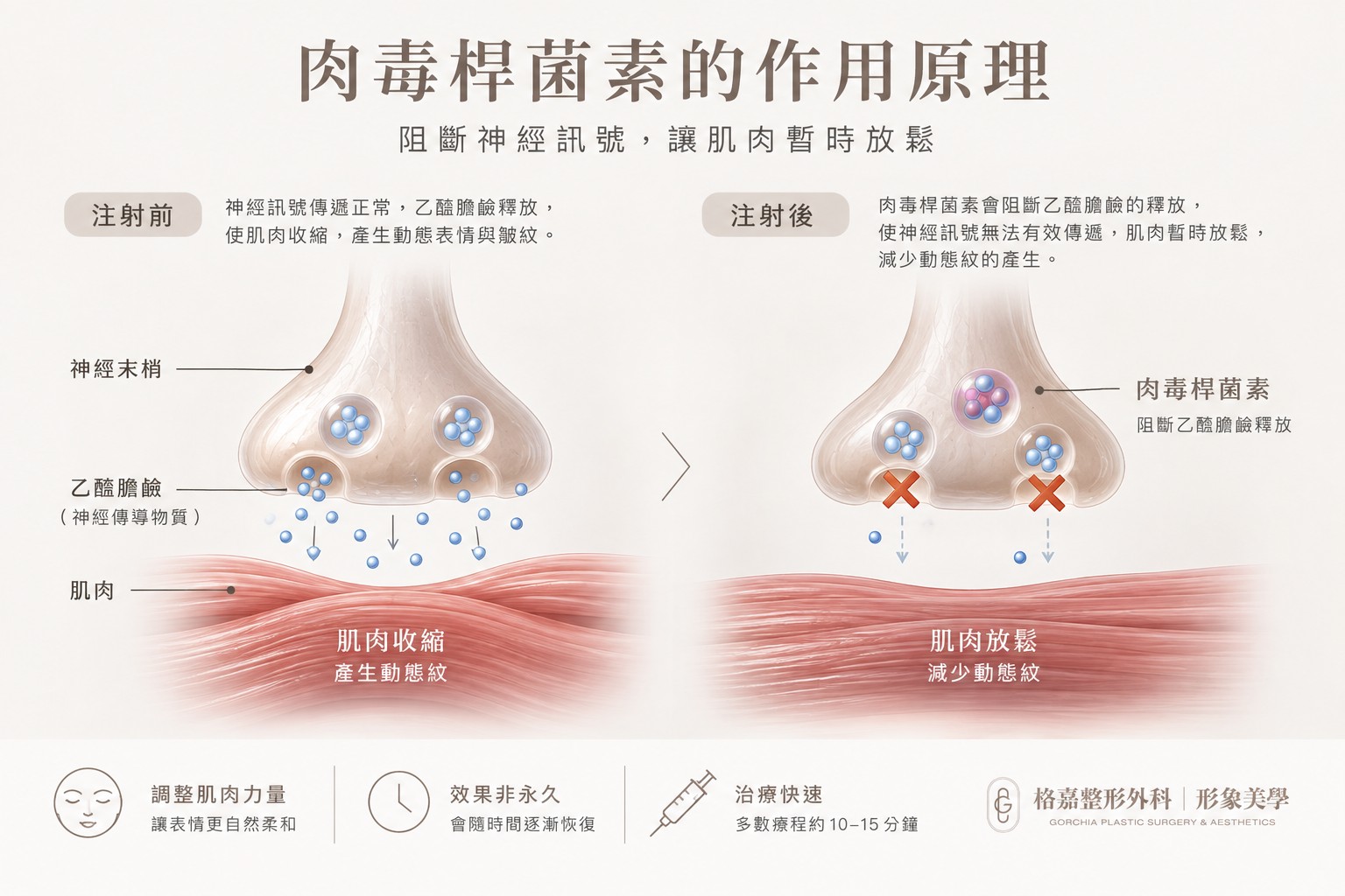 botox-action