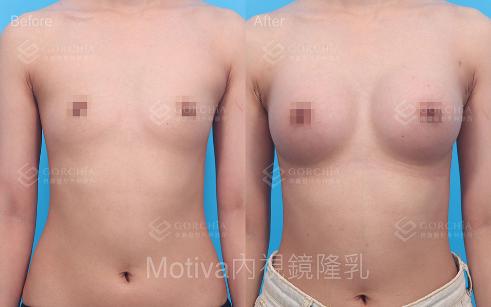 MOTIVA魔滴-1