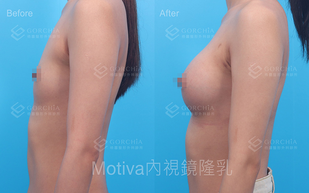 MOTIVA魔滴-2
