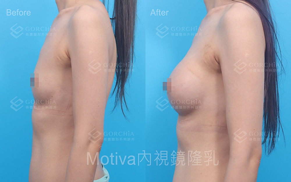 MOTIVA魔滴-6