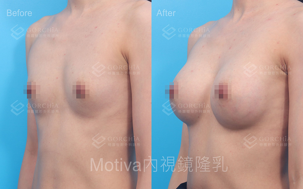 MOTIVA魔滴-8