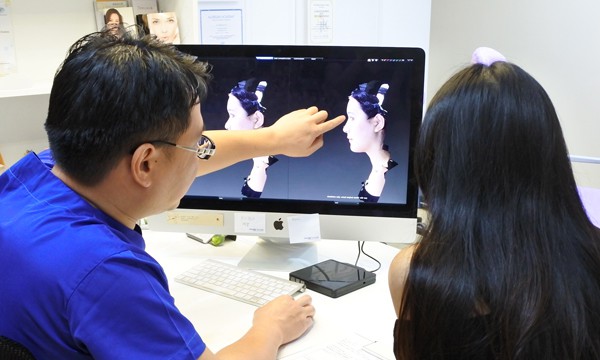 隆鼻3D模擬＿診間即時模擬比對