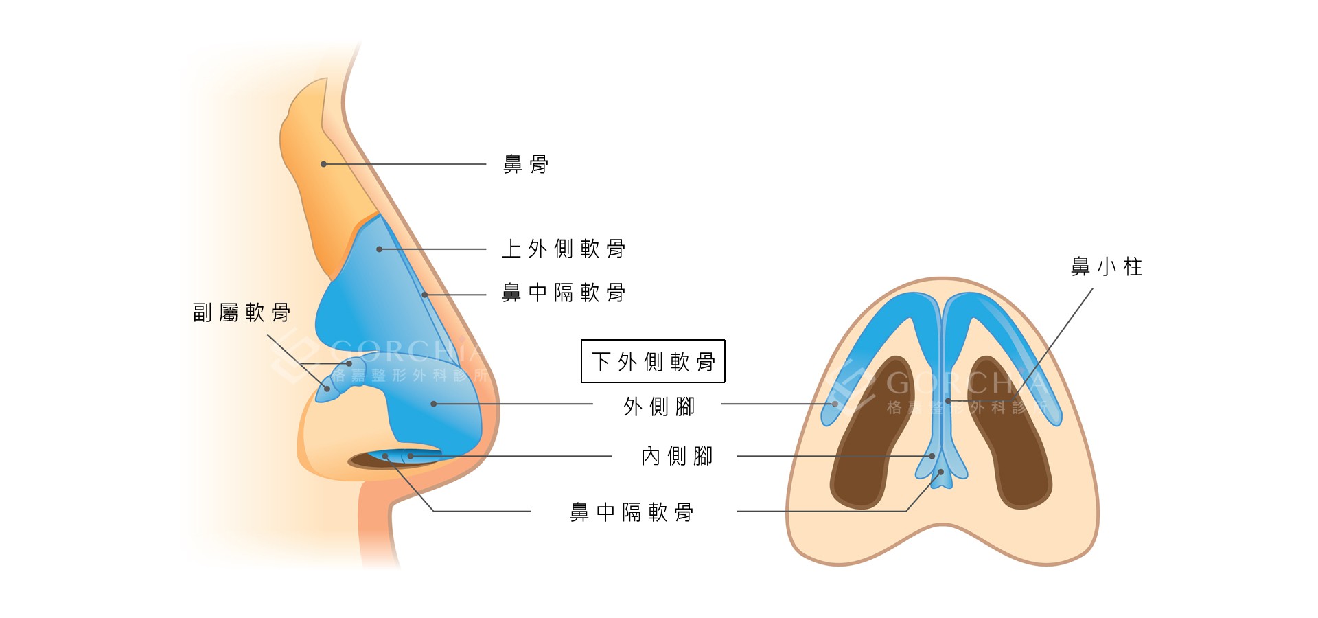鼻頭肥厚過於寬大，不夠立體沒有型，是東方人種普遍的鼻型缺點