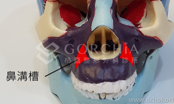 鼻溝槽解剖部位示意圖