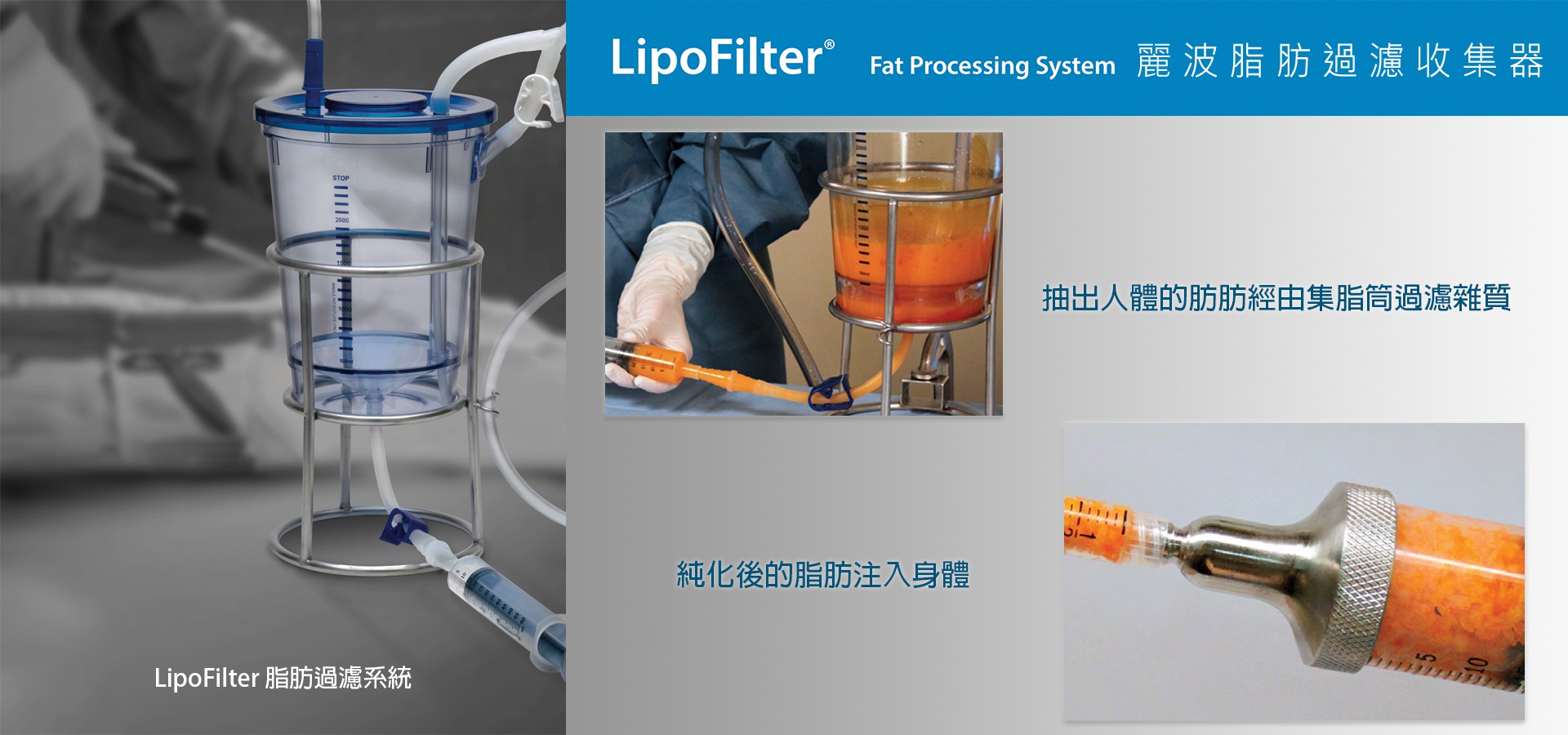 精微自體脂肪隆乳優點