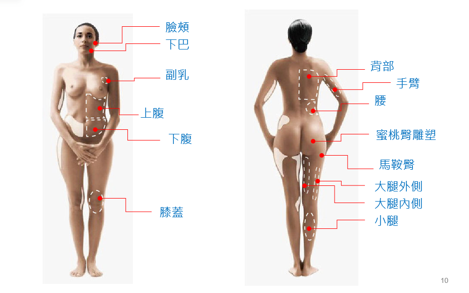 威塑抽脂適用部位女性