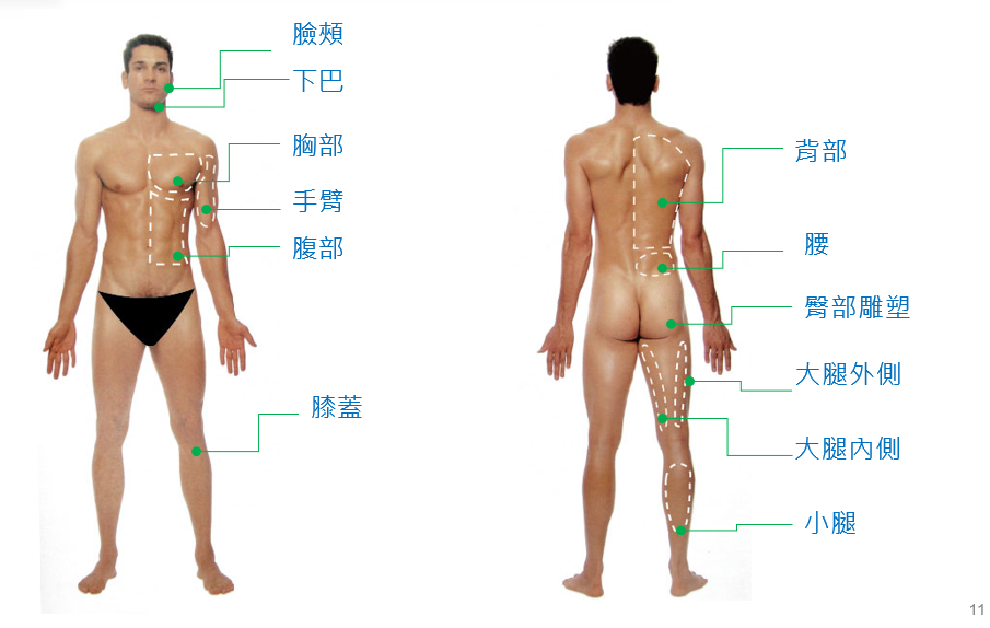 威塑抽脂適用部位男性