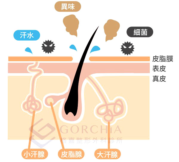 狐臭手術推薦文章-狐臭的成因