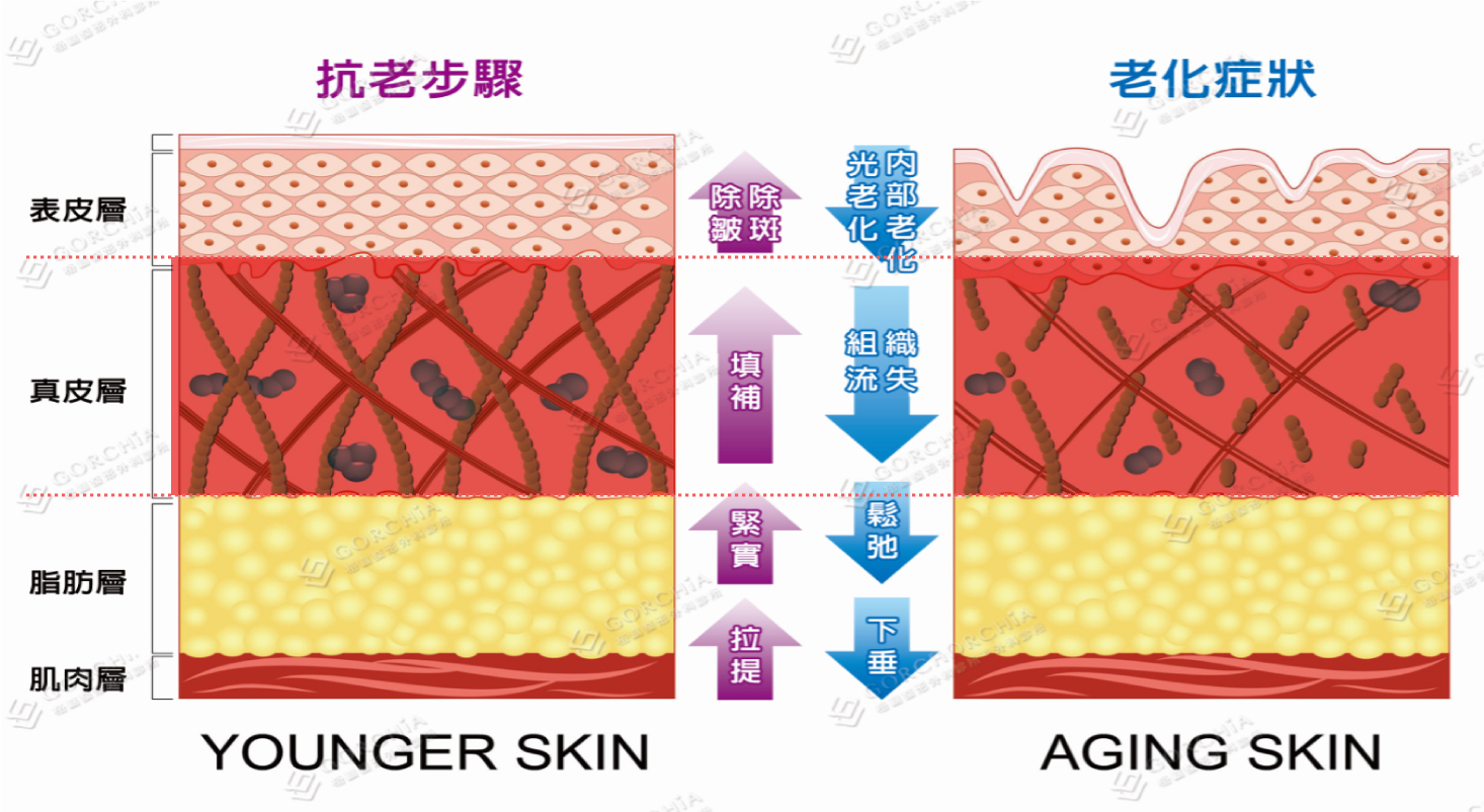 台中玻尿酸,台中玻尿酸推薦