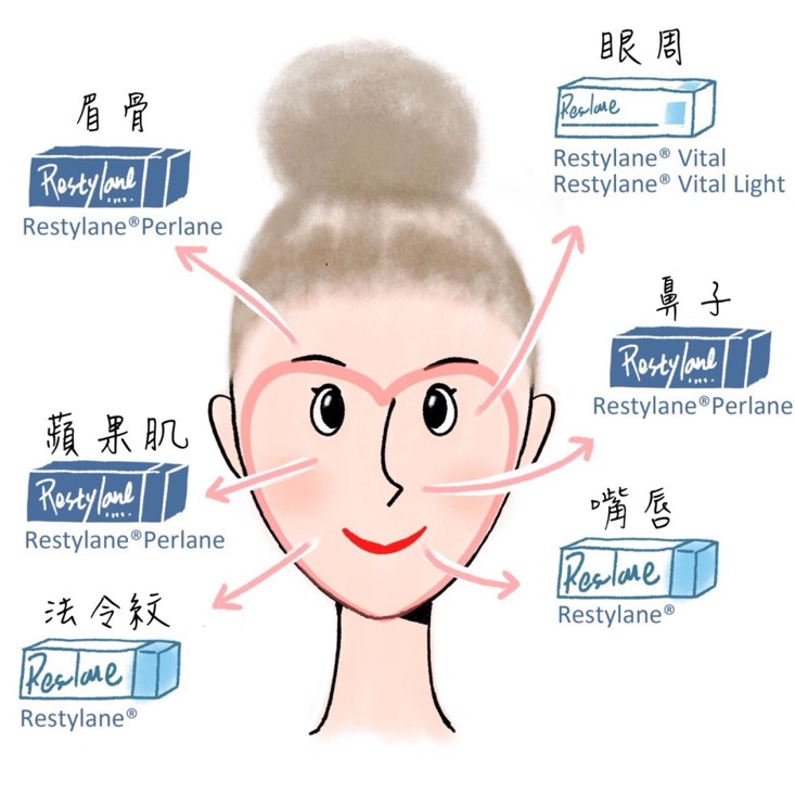 玻尿酸適用範圍,台中玻尿酸,台中玻尿酸推薦,玻尿酸種類