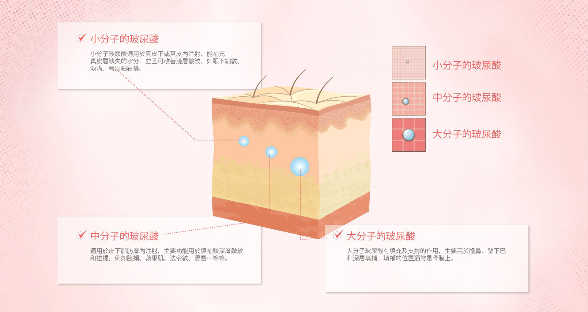 玻尿酸種類,玻尿酸不同分子大小特性