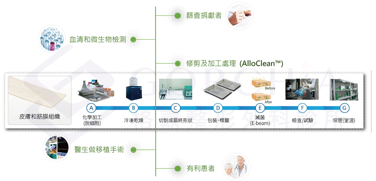 異體真皮,異體真皮法令紋,異體真皮是什麼