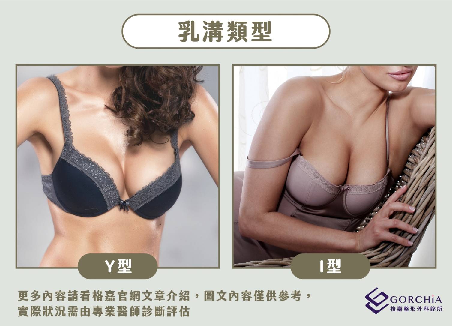 乳溝類型－格家專業隆乳手術