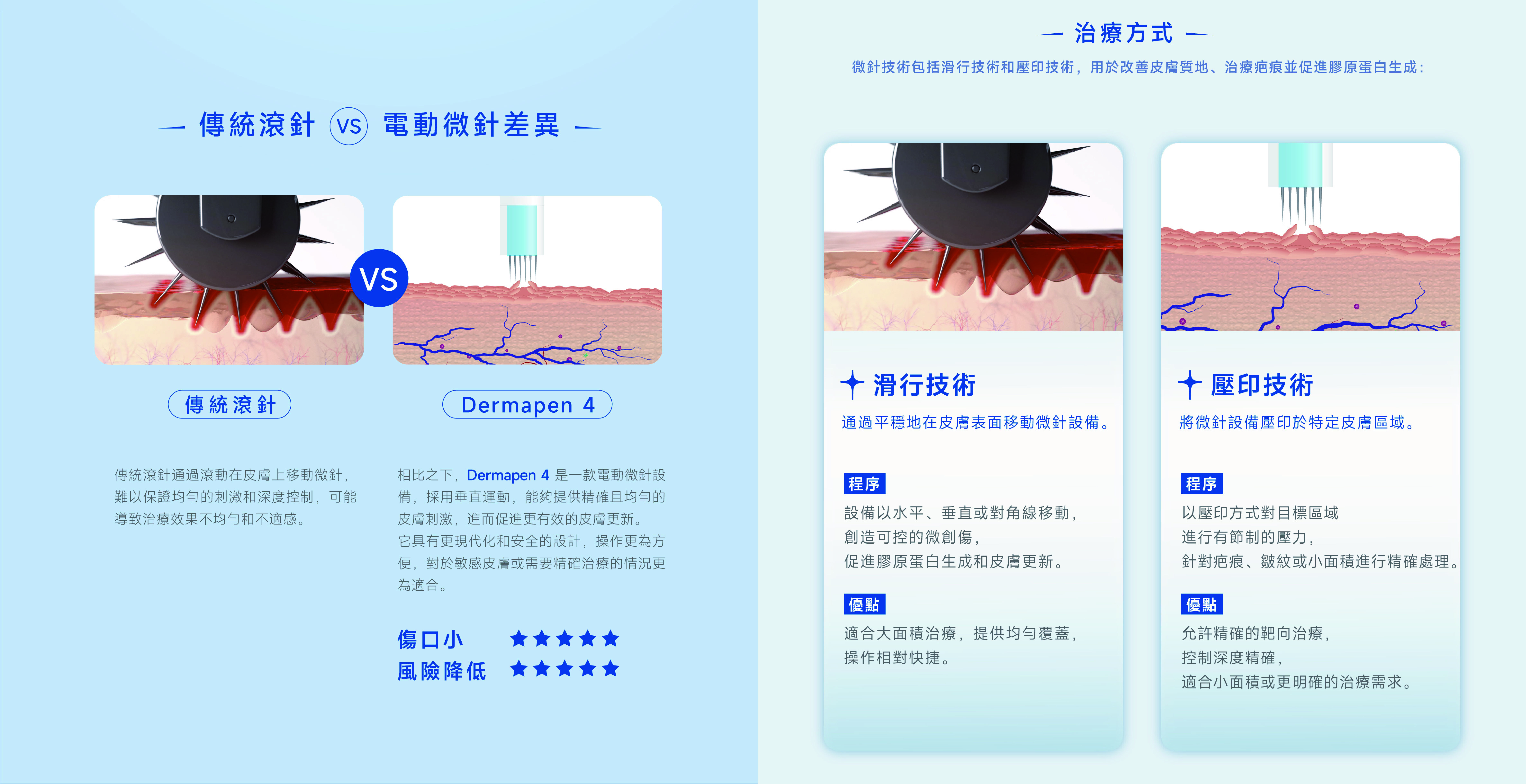 微針筆,Dermapen